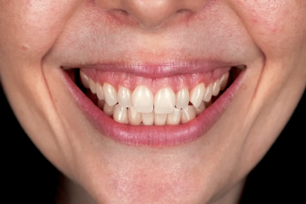 Affordable Cosmetic Dental Service