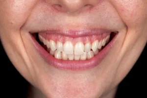 Affordable Cosmetic Dental Service