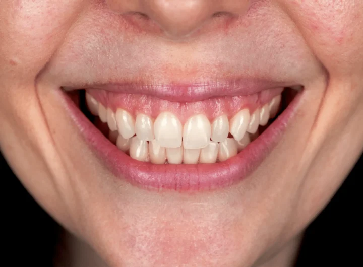 Affordable Cosmetic Dental Service